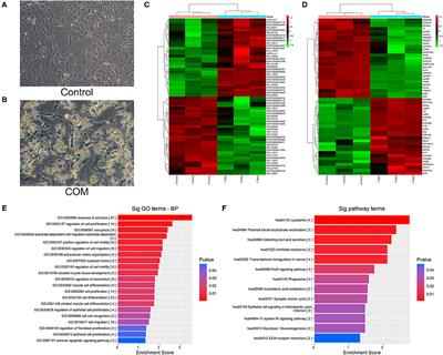 LncRNA SPANXA2-OT1 Participates in the Occurrence and Development of EMT in Calcium Oxalate Crystal-Induced Kidney Injury by Adsorbing miR-204 and Up-Regulating Smad5